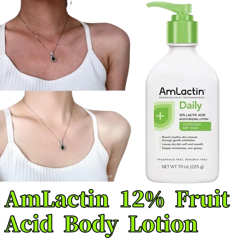 Spot American AmLactin 12% Fruit Acid Body Lotion 225g Whitening, Moisturizing, and Exfoliating Chicken Skin A