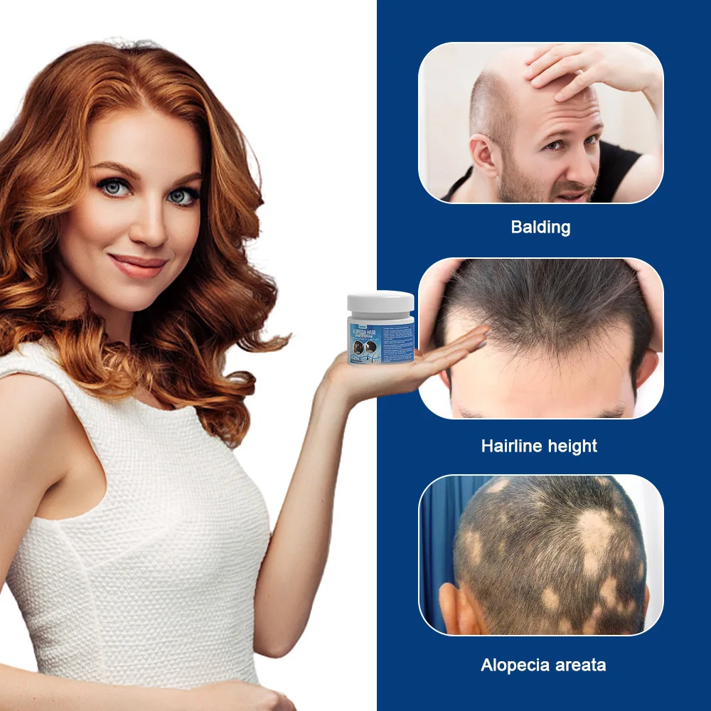Hair Growth Cream Fast Regrowth Essential Strengthen Hair Roots Anti Hair loss Baldness Repair Damaged Scalp Skincare Product