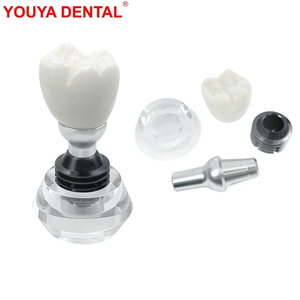 Dental Implant Teeth Model For Studying Training Practice Teaching Demo Dentistry Detachable Typodont Crystal Crown Tooth Model