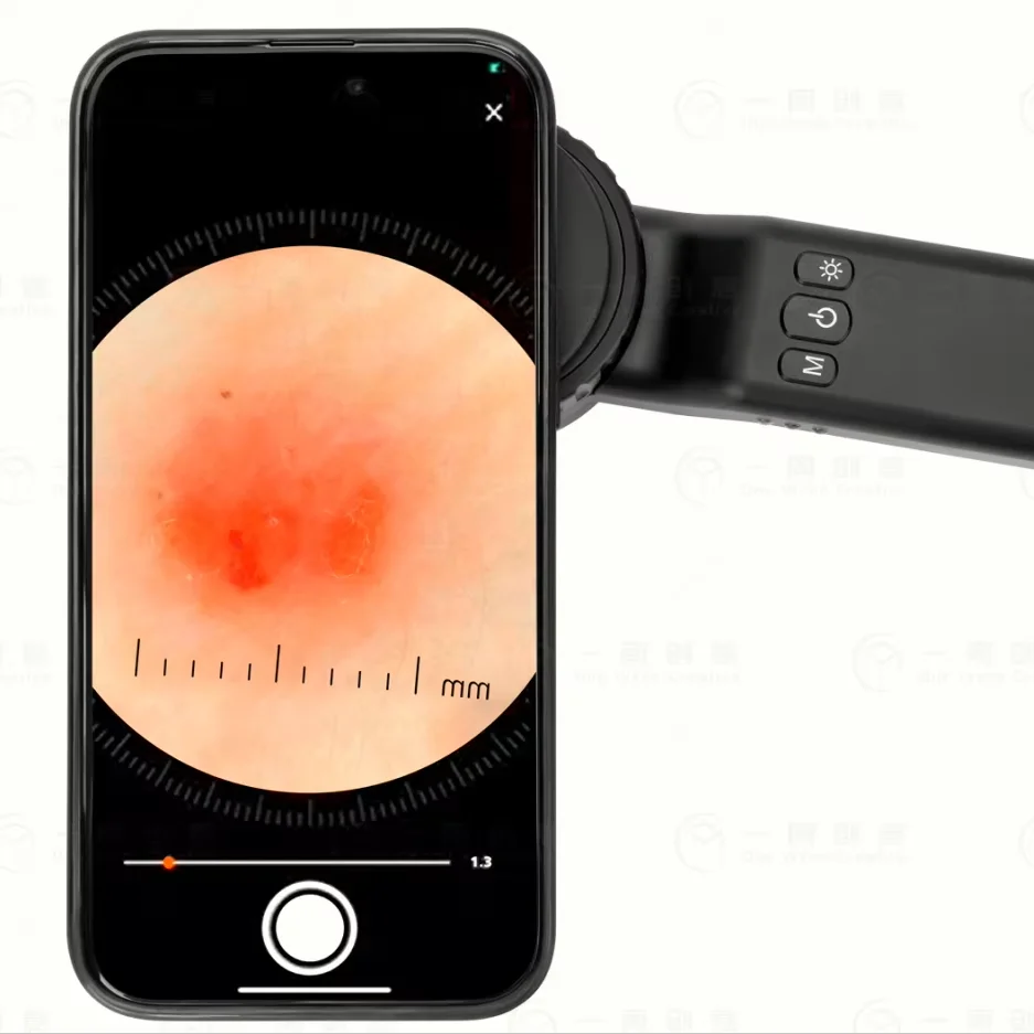 

Дерматоскоп IBOOLO DE-4100 с 10-кратным увеличением, кросс-поляризационный и неполяризационный, металлический