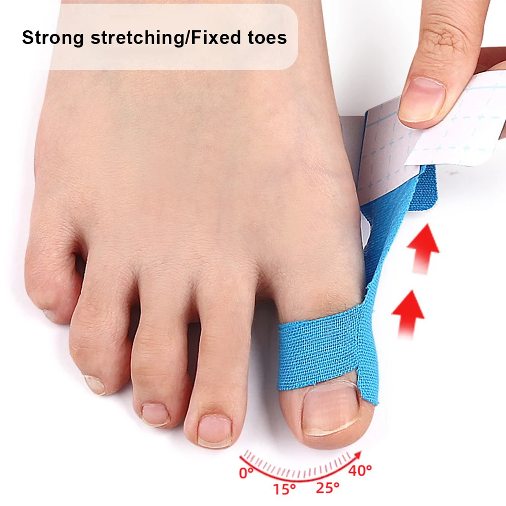 Corrector de juanete, alisador de juanete autoadhesivo, correa ortopédica para juanete, Corrector de órtesis Hallux Valgus, herramienta para el cuidado de los pies, 10 Uds.
