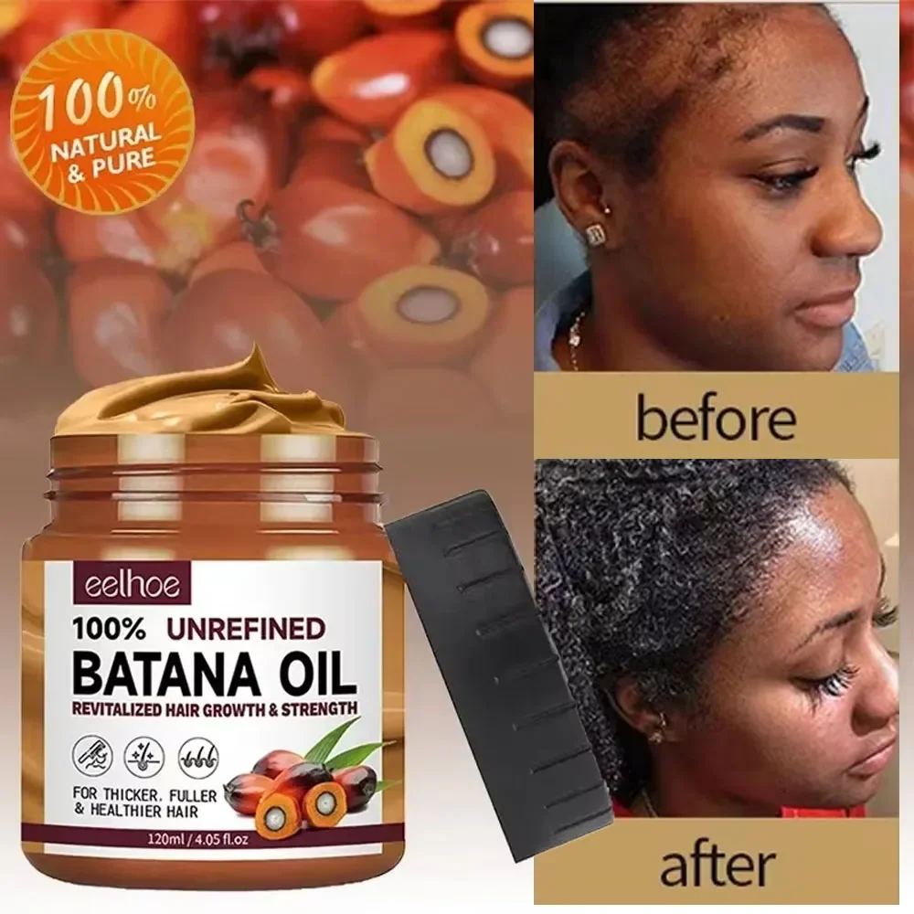 Batana Hair Growth Oil Conditioner Anti Hair Loss Products Fast Growing Hair Mask Nourishing Repair Roots Hairs Care for Women