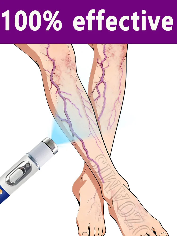 

Здоровые вены нет больше варикозного расширения. Красивые ноги, ноги и руки.