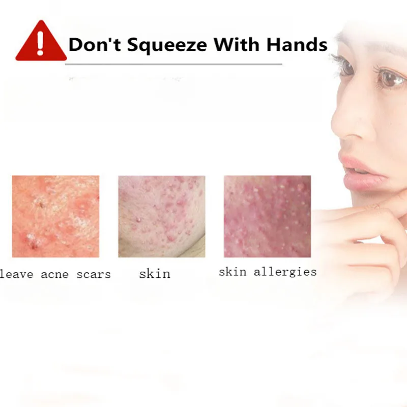 Profissional de aço inoxidável ferramenta removedor cravo comedone acne espinha agulhas extrator mancha removedor pele rosto cuidados ferramenta