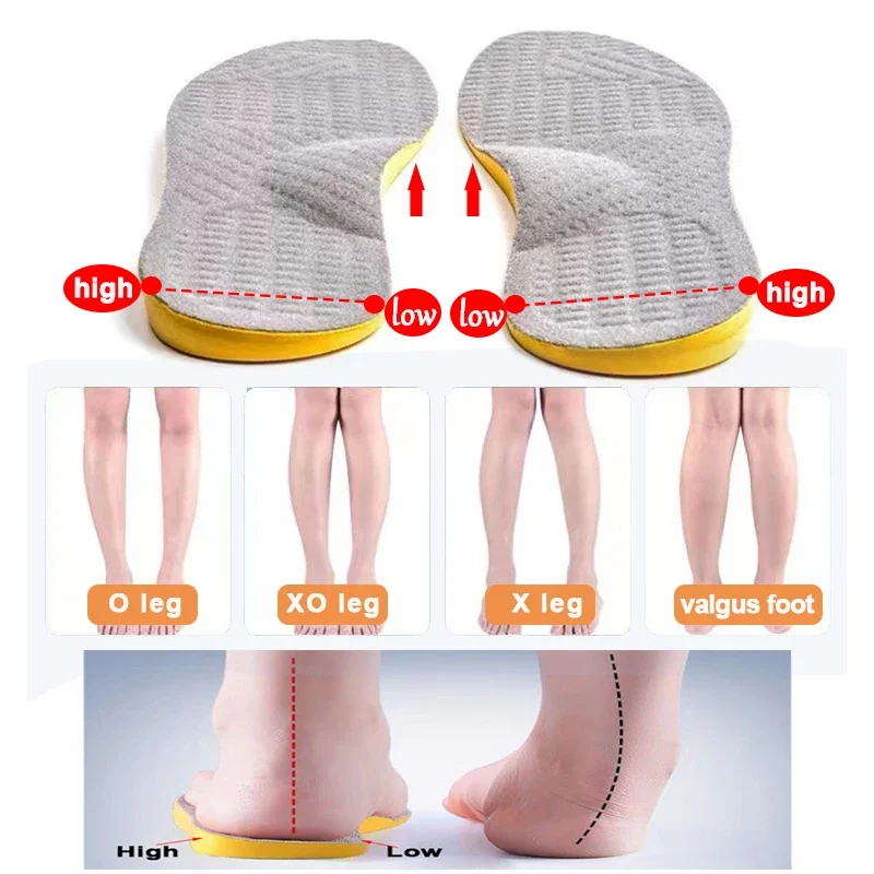 Semelle intérieure orthopédique en PU pour enfants, coussin de pied d'arc de pied plat, support de chaussures de sport, insertion de coussin de chaussure, type X O