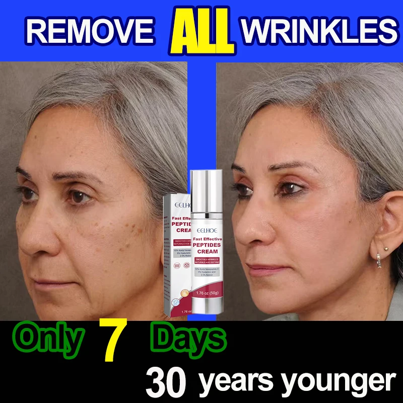 

Whitening cream, anti-wrinkle cream, tighten skin, moisturize, remove melanin, freckles, acne deposits on the skin, bright skin