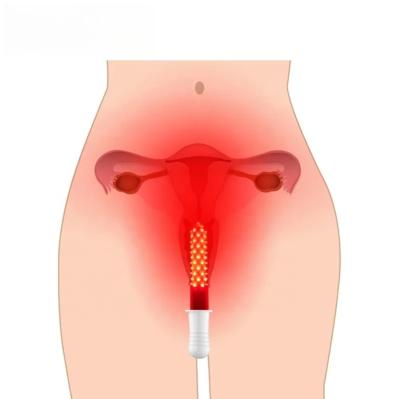 Instrumento de aperto de parede vaginal portátil para uso doméstico, dispositivo de cuidados de saúde para vagina feminina, instrumento de fisioterapia ginecológica