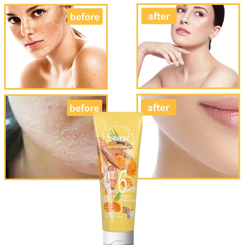 

1pc / 5pcs 180G Turmeric Ginger Scrub Deep Exfoliating Chicken Skin Moisturizing Softening Skin Brightening Skin Tone Skincare