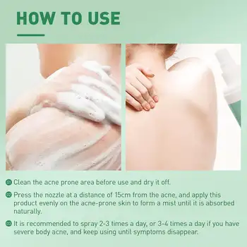 10 best sales Sırt sivilce spreyi - №7