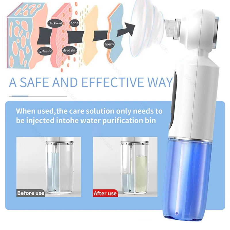 2025 Nuovo Aspirapolvere per pori per la rimozione di punti neri con impacco caldo Detergente idratante per il viso elettrico Estrattore di brufoli Dispositivo di bellezza per il viso