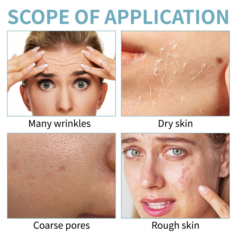 Esfoliante Essência Hidratante Hidratante Esfolia, fornece hidratação e desperta vitalidade da pele