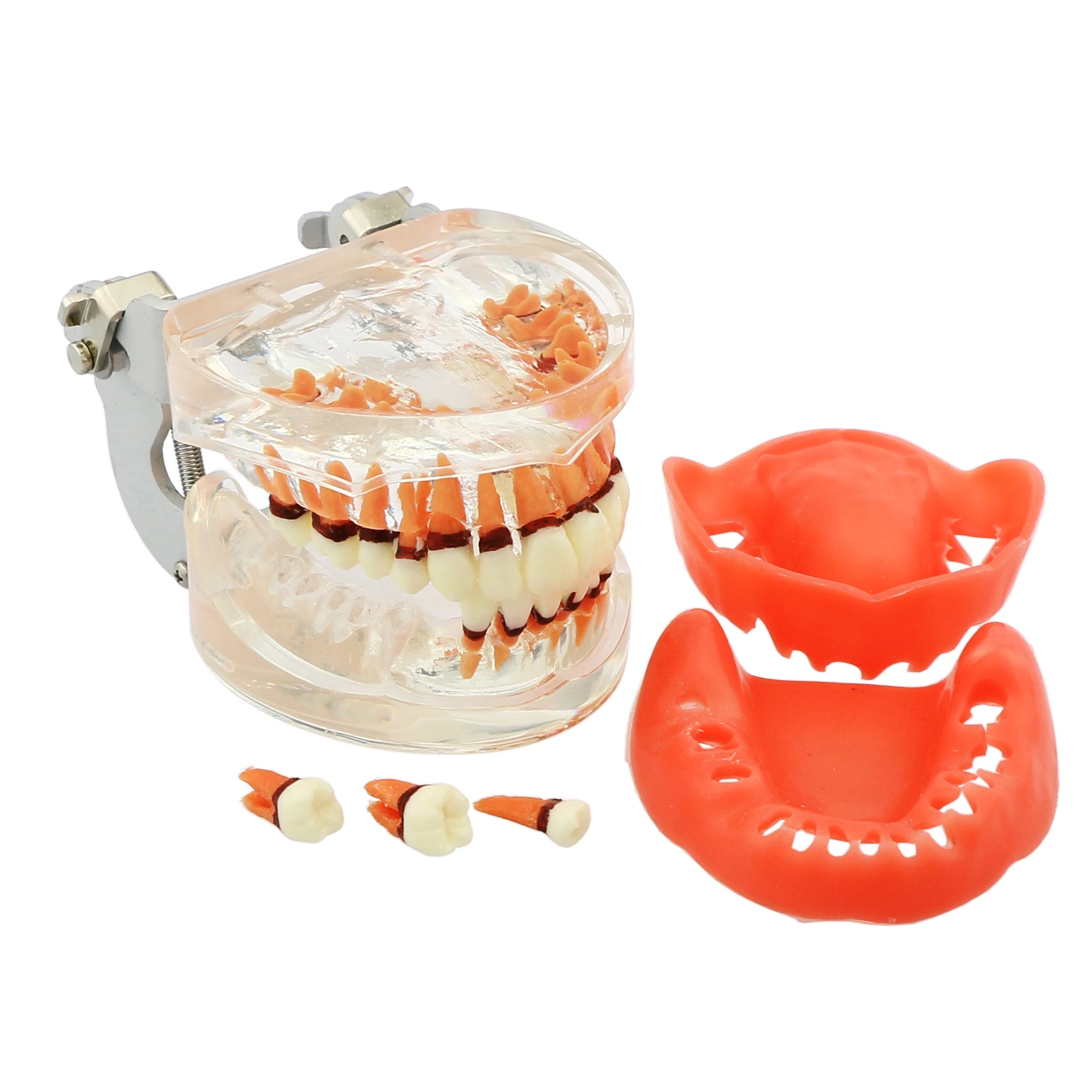 Dental Periodontal Typodont Teeth Model M4017 Pathology Recession Heathly Gingivae Tartar Demonstration Study Soft Gums