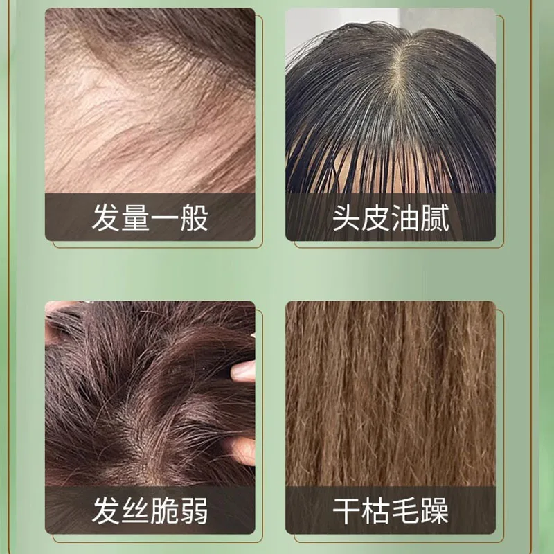 Herbal Hair Strengthening Nourishes Shampoo 380ml - Scalp Care Oil Control  Reduces Breakage for Fuller, Healthier-Looking Hair