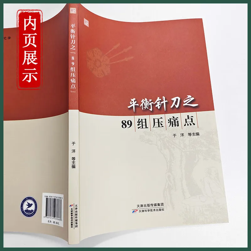 مزيج من التقنيات الإجرائية السريرية في علاج الوخز بالإبر وتطين نقطة الوخز الدقيقة #2