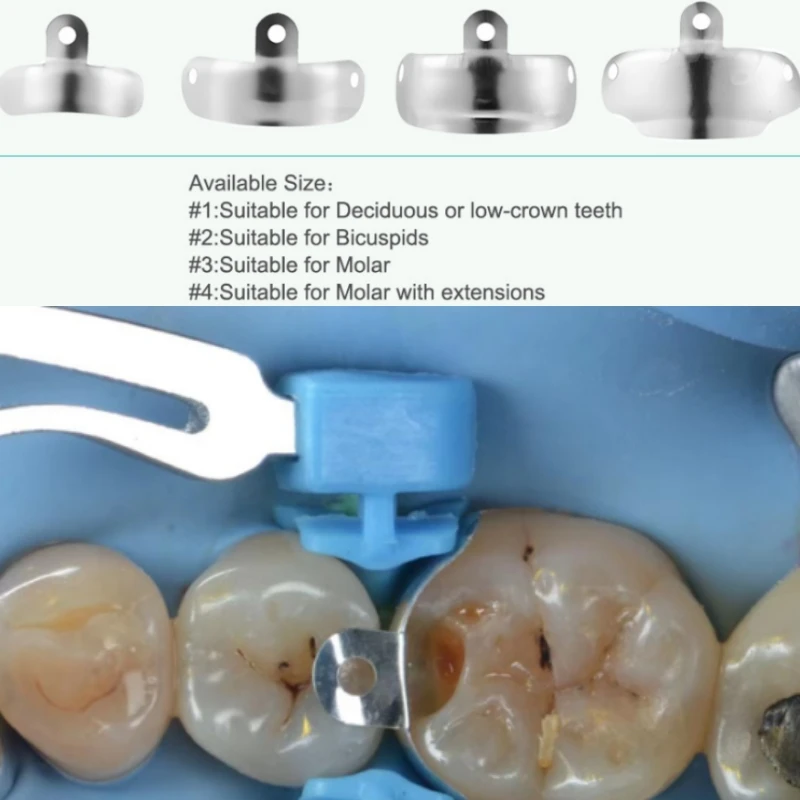 

Dental D2 Forming Matrix System Nickel Titanium Universal Clamp Ring Sectional Contoured Matrix Bands M4 Tooth Restoration Tools