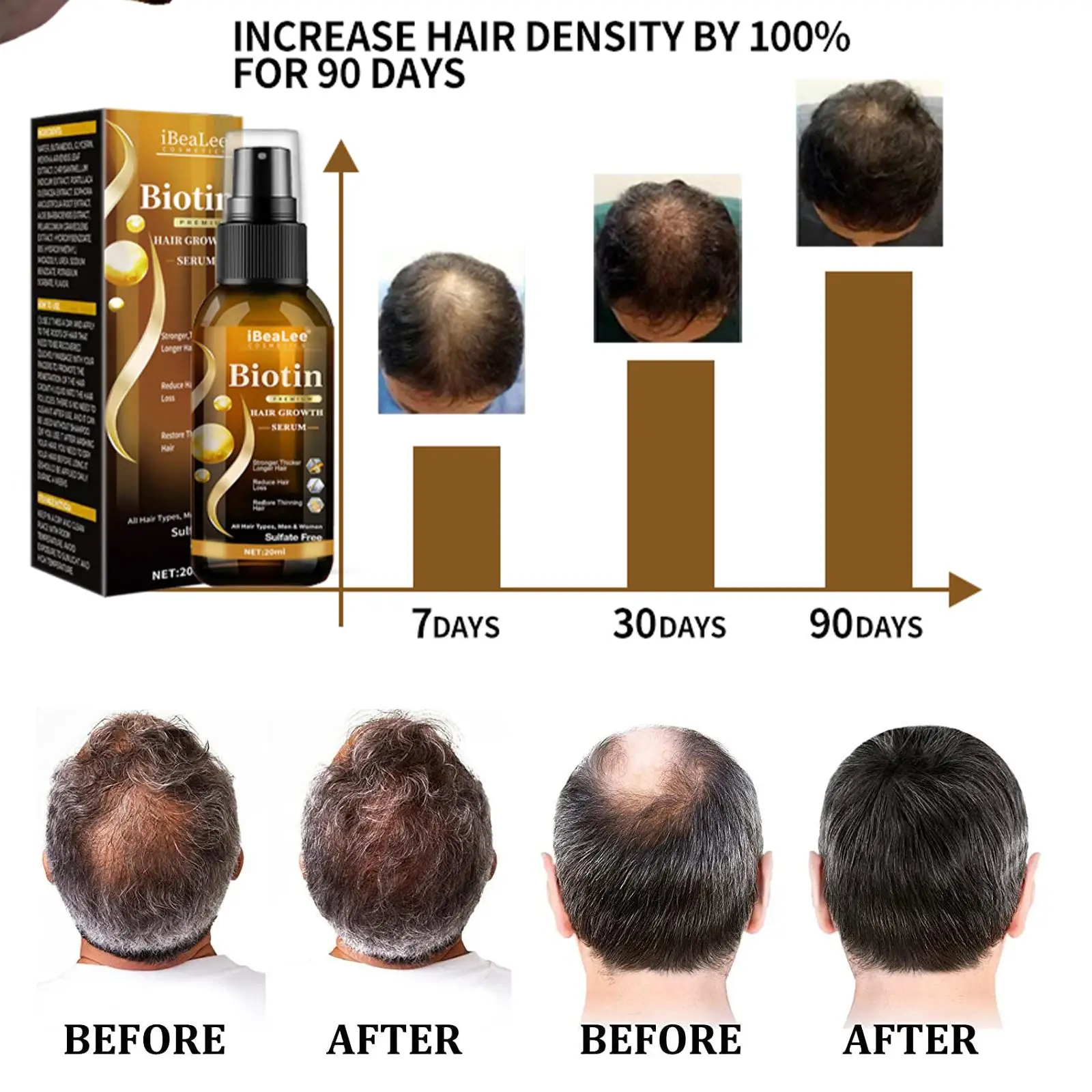 IBeaLee Biotin Anti Hair Loss Spray 1/2/3pcs Scalp Treatment Products Fast Growing Hair Care Essential Oils For Men