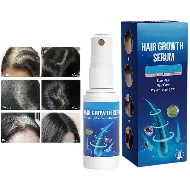 Hair Growth Spray For Men Nourishing Repair Liquid For Hair Loss Stop Hair Loss 30ml Natural Hair Spray Hair Growth Products