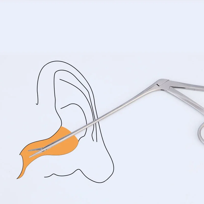 Earwax Remover Micro Crocodile Forceps Medical Ear Wax Pick Tongs Earpick Nose Operational Cleaning Clip Ear Nose Cleaning Tool