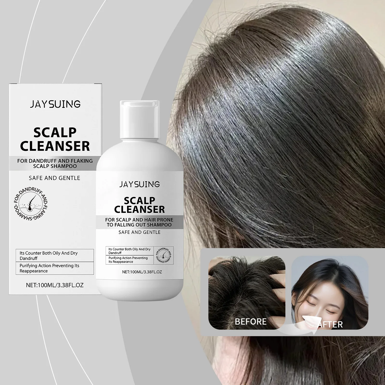 

Очищающий шампунь для волос головы, нежный контроль жирности, удаление перхоти, освежающий шампунь для разглаживания, более мягкие средства по уходу за волосами