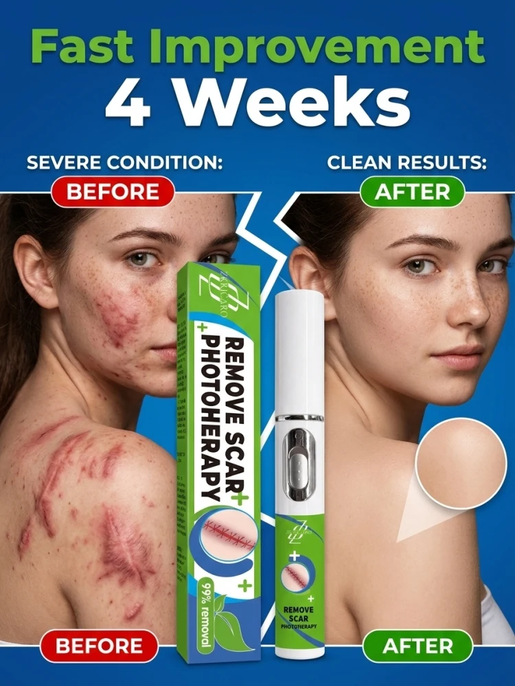 Handheld Personal Skin Care Massage Pen, Travel Friendly Body & Facial Beauty Tool, Gentle for Daily Home Use, Helps Improve The Appearance of Uneven and Bumpy Skin Surface