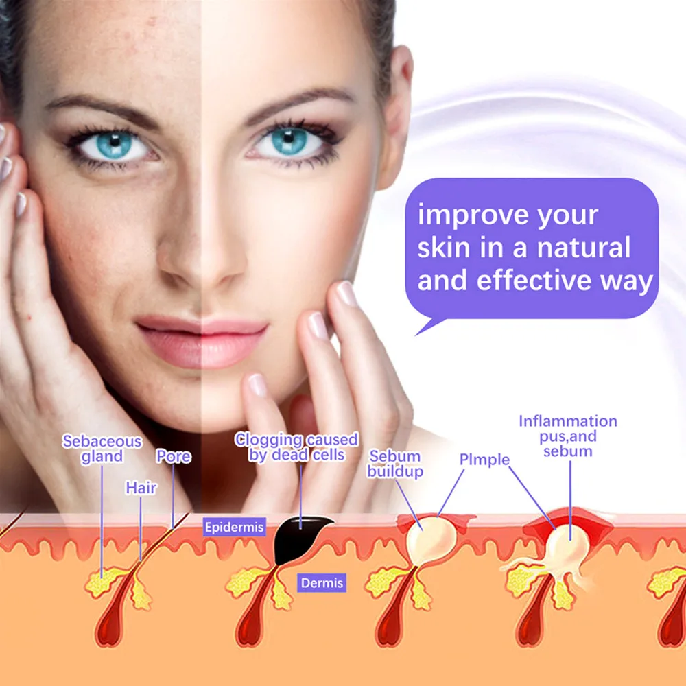 Urządzenie do pielęgnacji twarzy 7 w 1 z wysoką częstotliwością, elektroterapia, różdżka elektryczna, pomarańczowa, fioletowa, argonowa, neonowa tuba szklana, urządzenie do pielęgnacji twarzy.