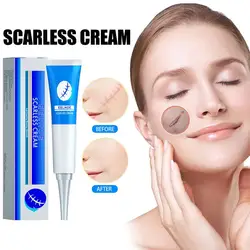 Scar Removing Cream Stretch Mark Removal Gel Face Body Acne Marks Injury Cesarean Burn Abrasions Scars Skin Repair Ointment