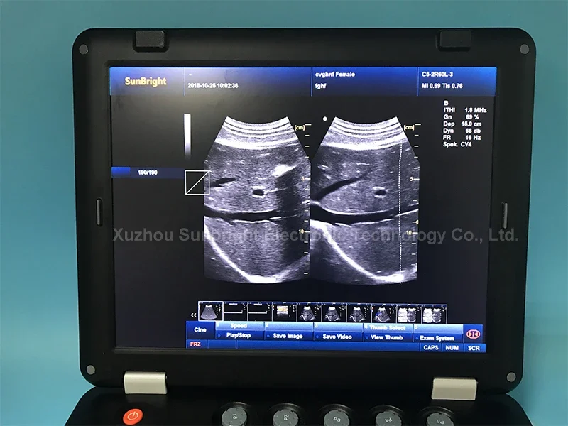 Sunbright ultrasound sun 906A 3d ecografo 4d color doppler ultrasound price