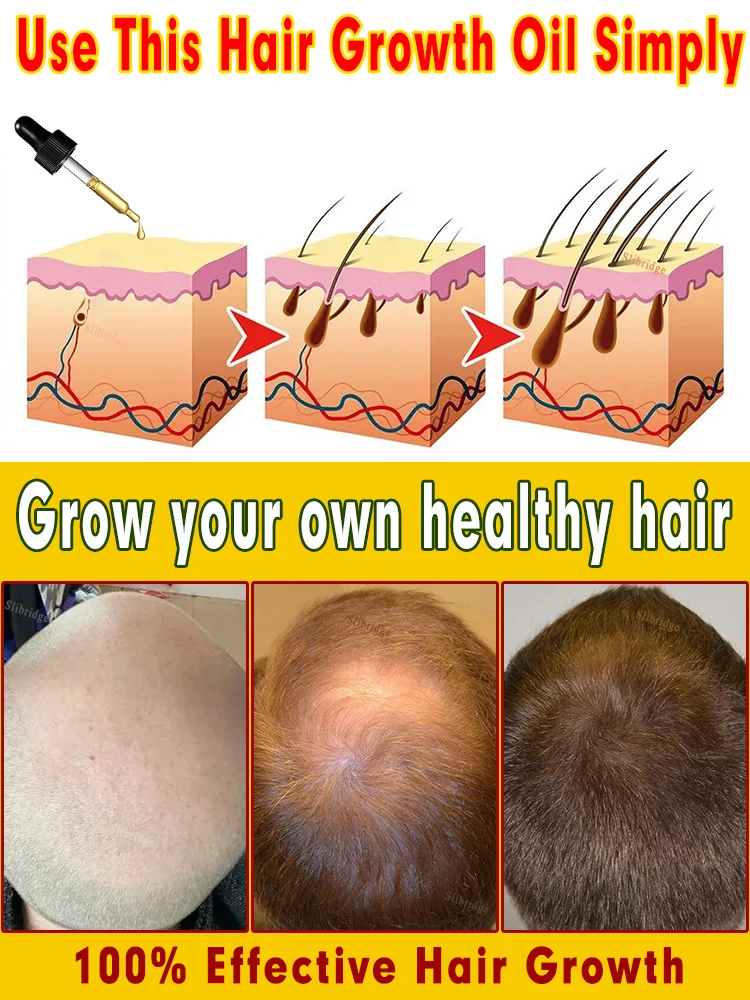 98% of buyers buy again, have more and more hair, say goodbye to baldness, thick hair,Hot selling product