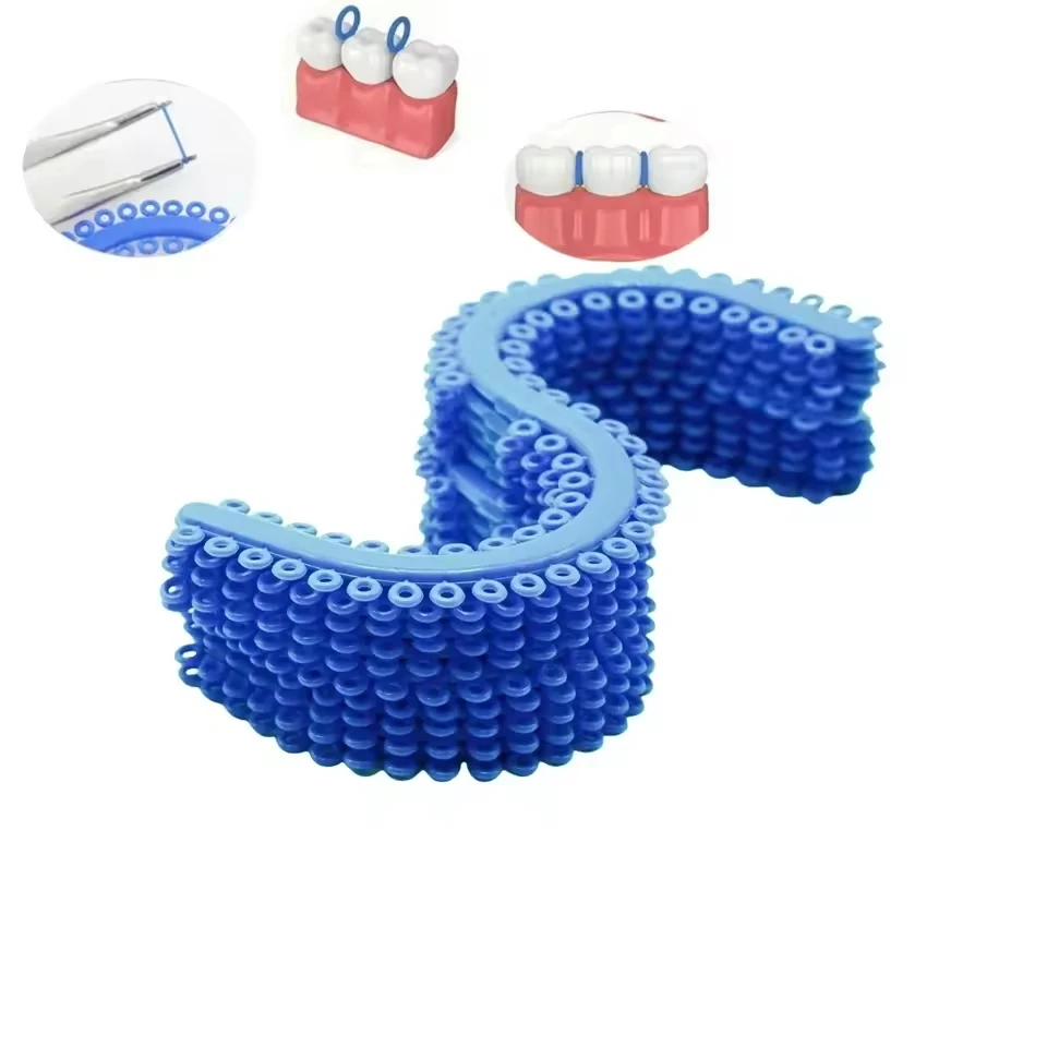 Dental Orthodontic S-Shaped Tooth Separators, Blue Elastic Tooth Separators, Dental Orthodontic Interproximal Gap Separation Rubber Rings, Orthodontic Treatment Interproximal Separation Oral Consumables