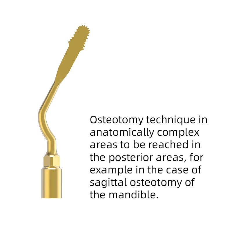 Bone Knife Machine Working Tip Wholesale Osteotomy Technique Anatomically Complex Areas for MECTRON Woodpecker US9 VVDental