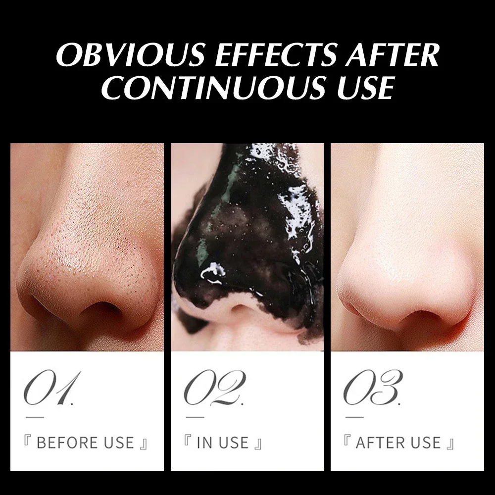 Oil-control Blackhead Remover Mask Nose Black Dots Acne Deep Cleansing Beauty Korean Skin Care Cosmetics for Women Men Face Mask