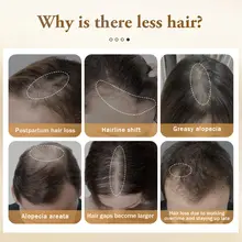 Ginger Hair Growth Spray 30ml #2