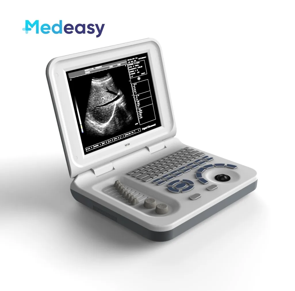 Veterinary Ultrasound Portable Black And White Ultrasound Scanner 10 Inches With 3.5 MHz Convex Probe