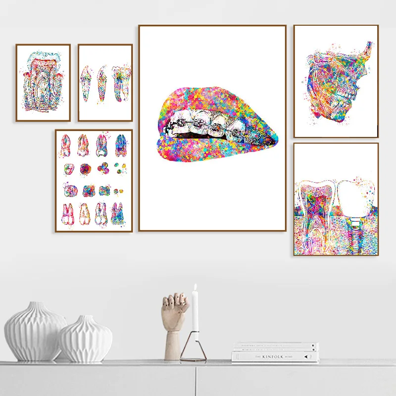 1 Stück rahmenlos, Zahnimplantat Zahnarzt Anatomie Medizinisches Leinwandgemälde Dental-Kunstposter Druck Wandkunst Dekor Bilder Krankenhaus Klinik