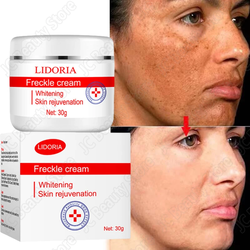 

Powerful Whiten Freckle Cream Fast Remove Melasma Melanin Correcter Anti-Pigmentation Dark Spot Fade Improve Dullness Skin Care