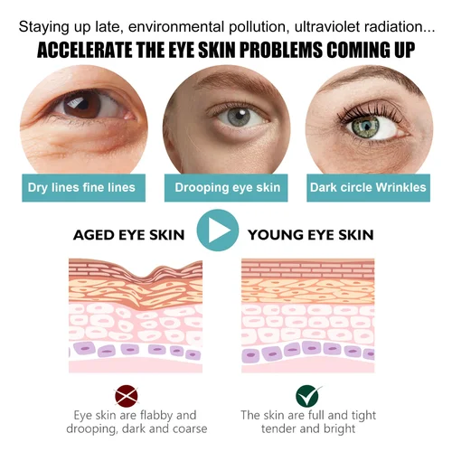 Imagen 2 del producto Crema para ojeras instantáneas, 5 unids/set, crema antienvejecimiento para debajo de los ojos, elimina bolsas de ojos, levantamiento de hinchazón, regordeta, reafirma los ojos, piel