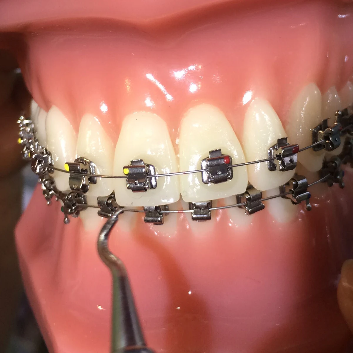 AZDENT Zahnspangen, kieferorthopädische Brackets, aktive selbstligierende 4-teilige Backenzangen, markierte Basis Roth 0.022, Haken 345 mit Werkzeug – Detail 4