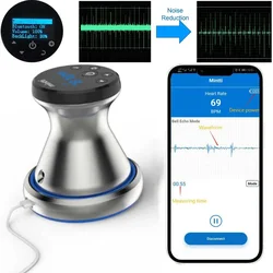 100x Bluetooth Digital Stethoscope Charge Stethoscope Audio Amplification Respiratory Diseases Pneumonia Asthma