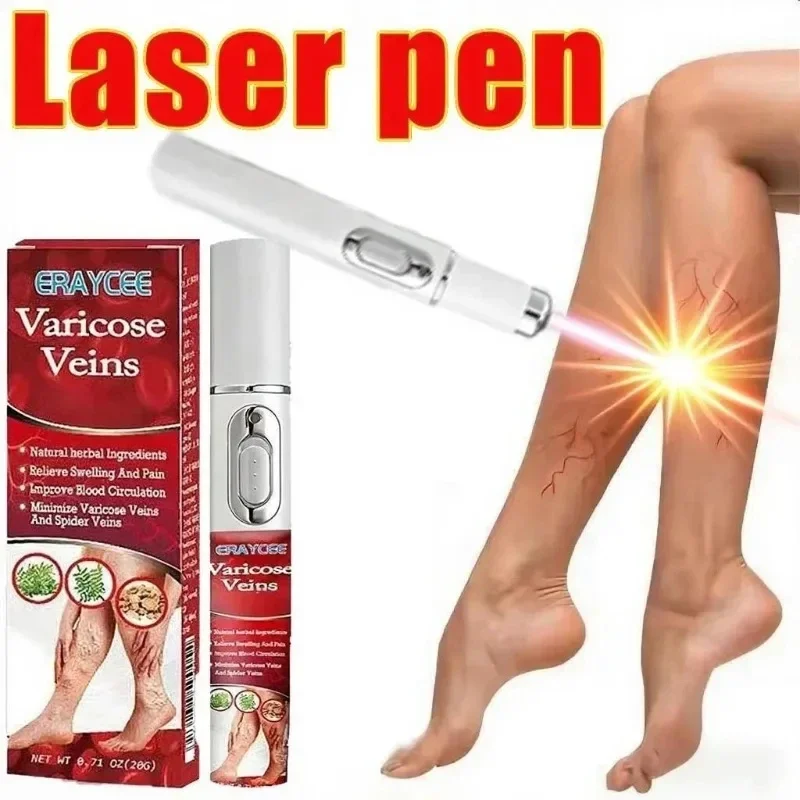 Stylo Laser para abat-jour, outil para varices, alivio eficiente de la vascularita dilatée dans les piernas, phlebite, amélio