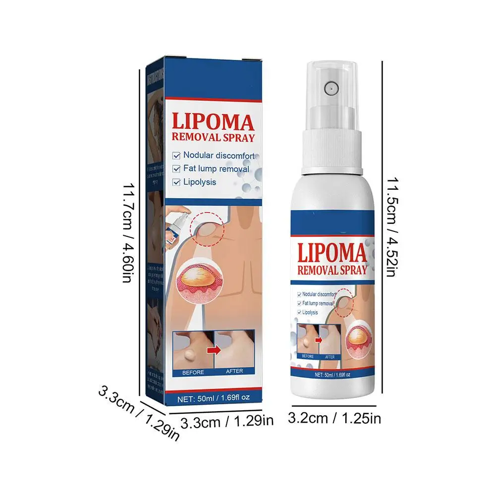 50ml Lipoma Removal Spray Anti tumorale gonfiore della pelle dolore lipolisi trattamento anticellulite Fibroma crema per alleviare i grumi di grasso corporeo