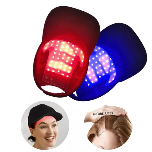 Dispositivo de terapia de luz roja y infrarroja para el cabello, gorro de crecimiento rápido, terapia de luz roja para el tratamiento de la caída del cabello con carga USB, antipelo