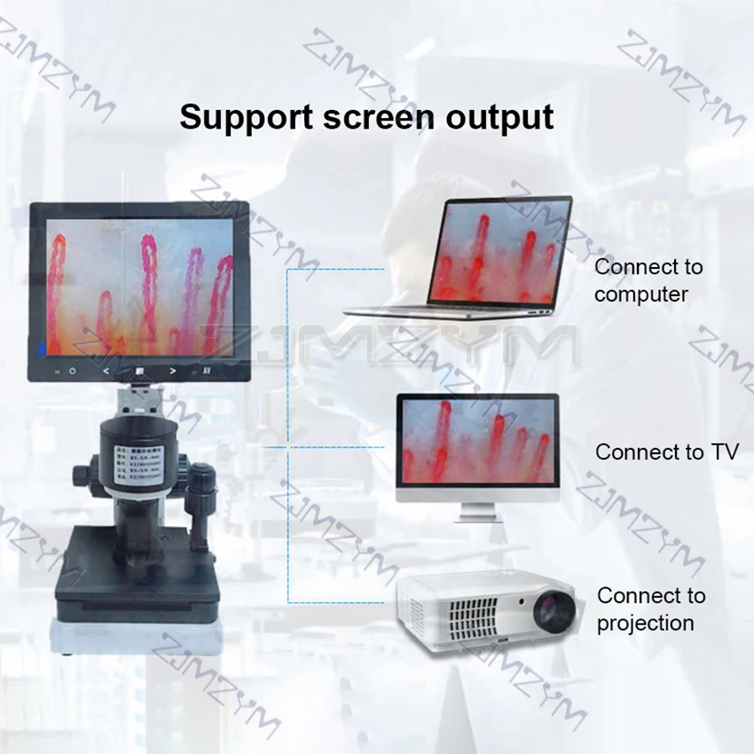 Digital Microscope Zoom Nailfold Capillary Microcirculation Detector Blood Microcirculation Analyzer with 7/8/9" Digital Screen