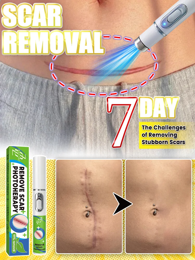 LE TUO PELLE BECOME NATURALE AGAIN!