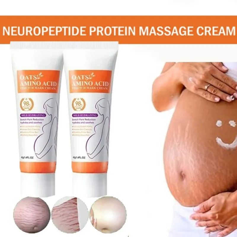 

Removes Stretch Mark Cream To Remove Postpartum Obesity Pregnant Women Repair Anti-Aging Winkles Firming Body Cream Skin Care