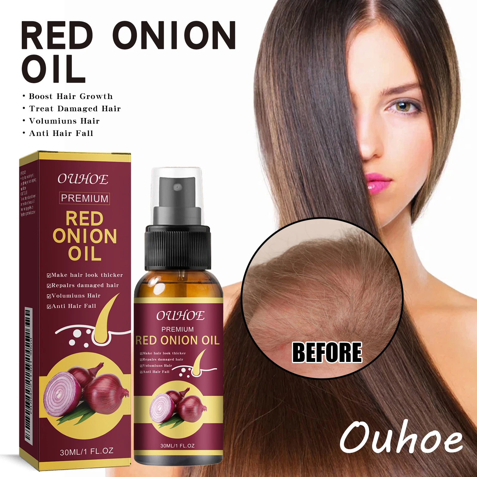

OUHOE луковая эссенция для ухода за волосами, масло для укрепления корней волос, увеличение объема, предотвращение выпадения волос, питательный спрей для ухода за кожей головы