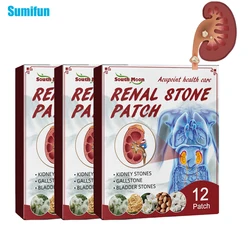 12/24/36Pcs Kidney Stones Removal Patches Body Detox Gallstones Renal Calculus Medical Plaster Urolithiasis Pain Relief Sticker