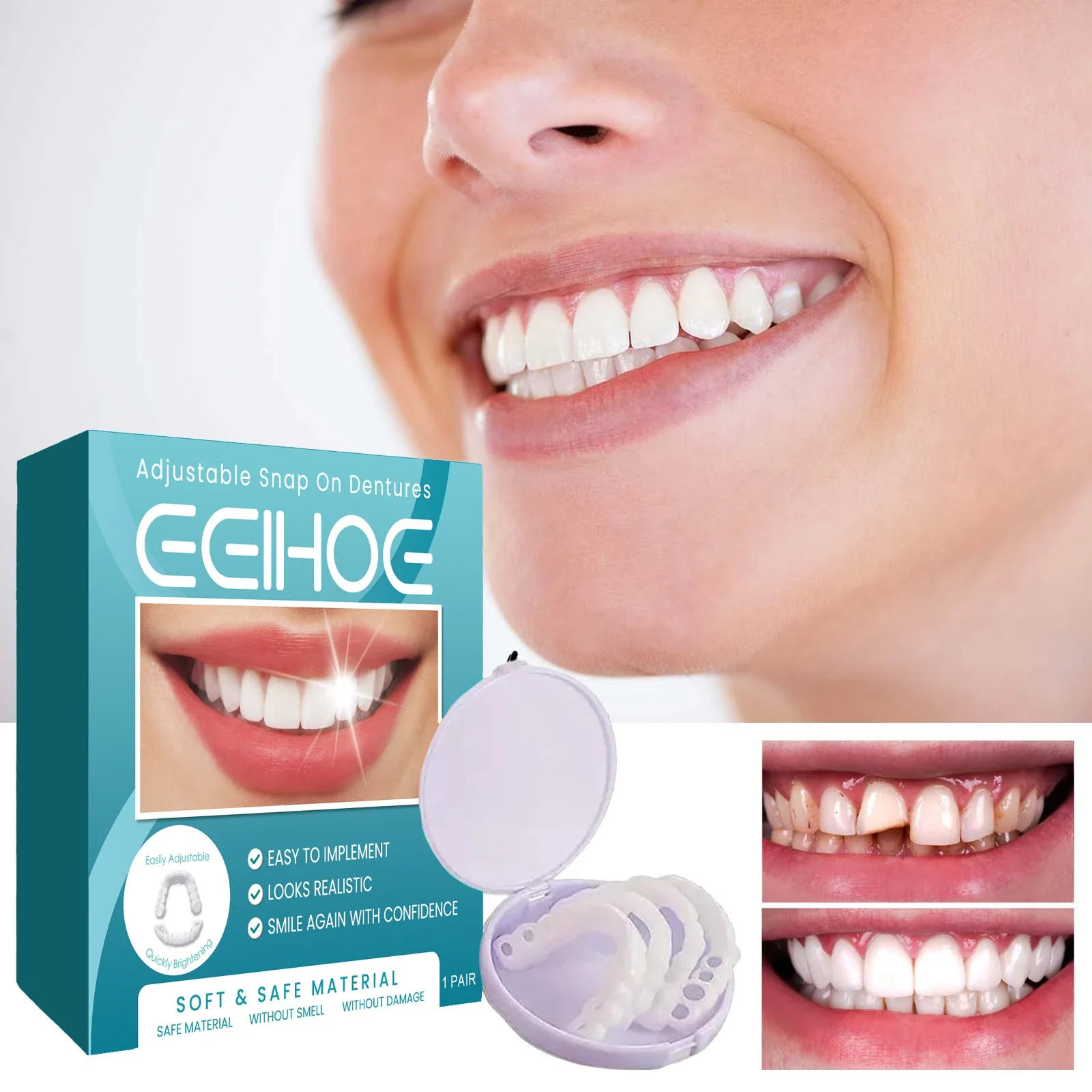 EELHOE Adjustable Buckle Denture Temporary Tooth Gap Filler Teeth Correction Fake Denture Kit for Oral Health Care