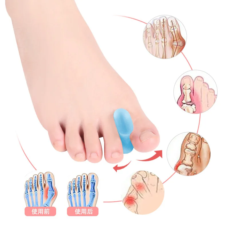 2Pcs=1Pair Silicone Toes Separator Bunion Bone Ectropion Adjuster Toes Outer Appliance Foot Care Tools Hallux Valgus Corrector