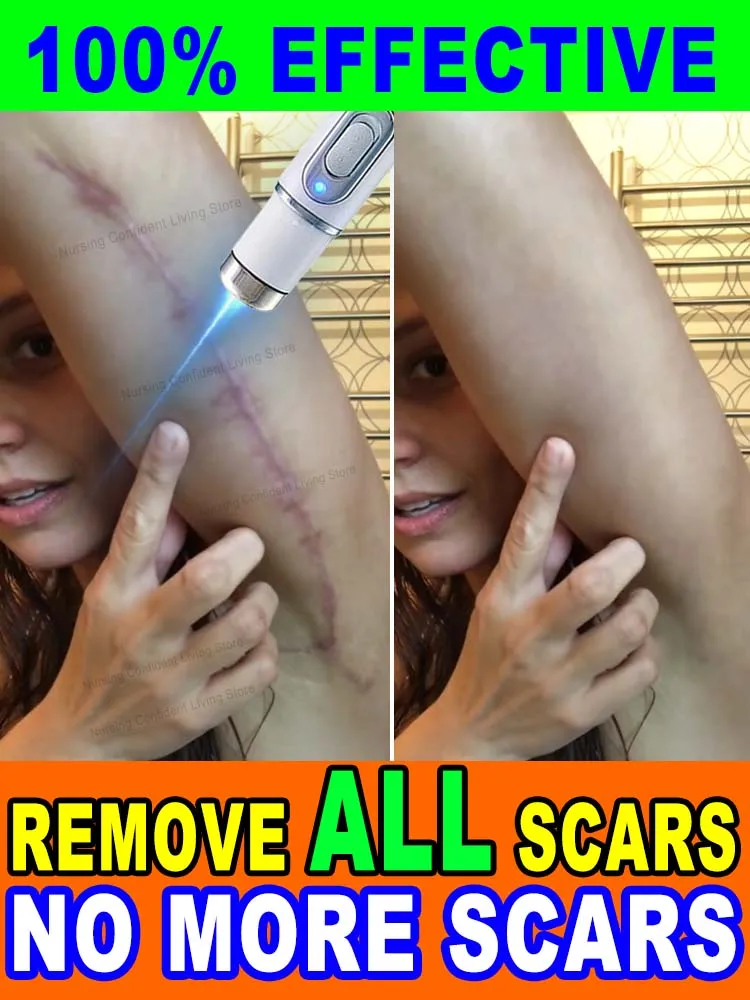 

Suitable for all kinds of scars