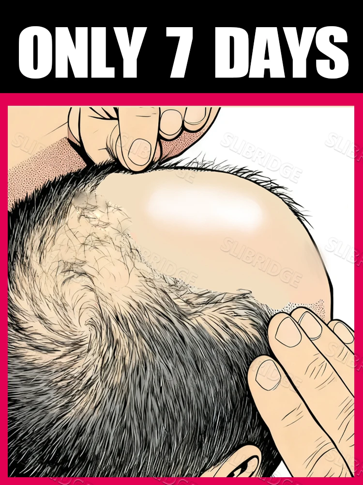 

Combination Set Meals Scalp Applicator Liquid Comb for Hair Scalp Treatment,Liquid Guiding Massager,Free shipping,unisex